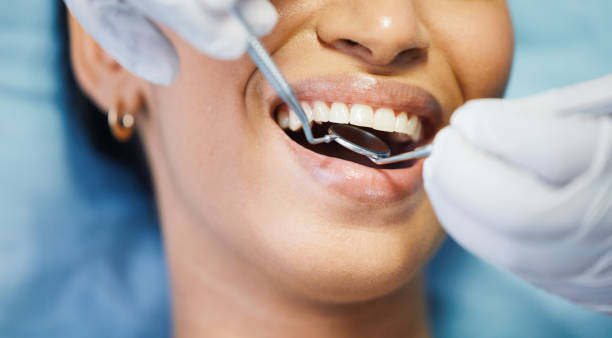Best Emergency Broken Tooth Repair in Orangetree, FL