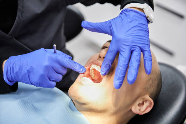Best Emergency Broken Tooth Repair in Orangetree, FL