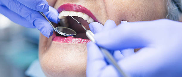 Best Emergency Tooth Extraction in Orangetree, FL